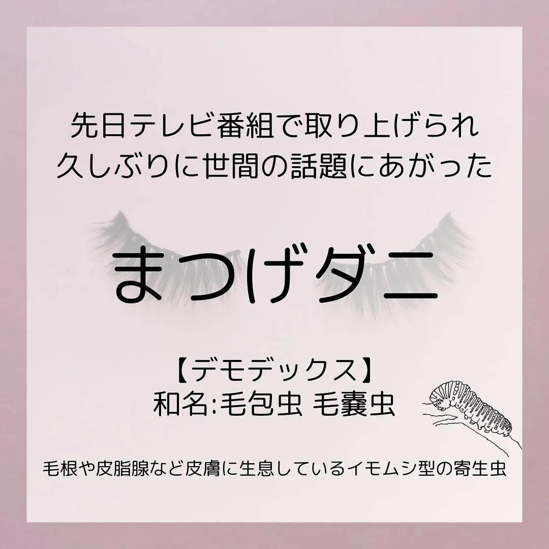 🫎あなたは大丈夫？恐怖のまつげダニ🫎