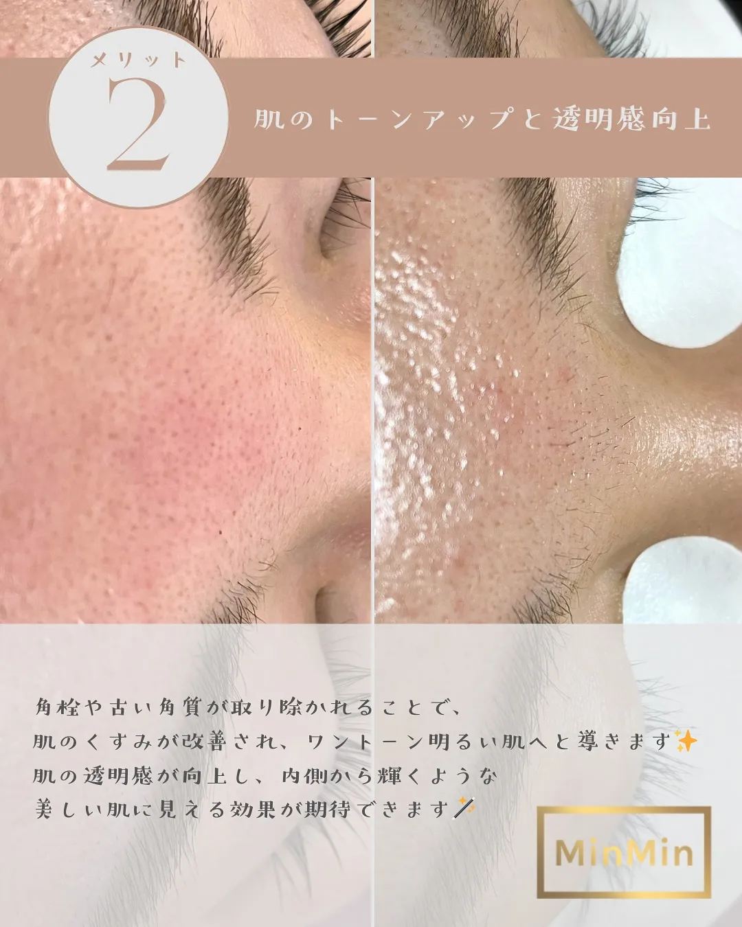実は…minminwax、脱毛だけじゃないんです🤫